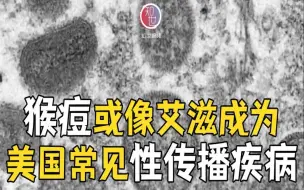 猴痘或像艾滋成为美国常见性传播疾病