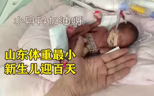 山东体重最小新生儿迎百天 出生时体重不到一斤