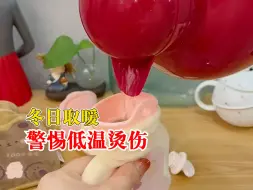 冬日取暖警惕低温烫伤