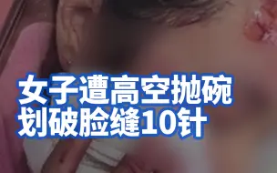 女子遭高空抛碗划破脸缝10针：从厨房扔出，里面还有吃剩的麦片