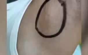 9岁女童得