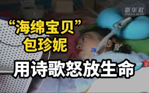 曾被诊断“活不过4岁”，但这位“海绵宝贝”已与世界较量20年！