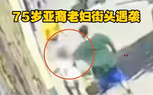 美国75岁亚裔老妇街头遇袭致眼眶骨折 嫌犯行凶后淡定离开