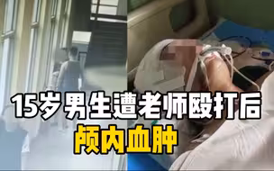 15岁男生遭老师殴打后颅内血肿 涉事老师：人是我打的，头是他道歉磕伤的