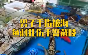 注意！男子手指被海鱼刺扎伤手臂截肢