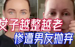 整容成瘾风险高？俄罗斯37岁女子整容后“变老”，惨遭男友抛弃