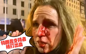 华盛顿冲突爆发！特朗普女性支持者被殴打致面部出血