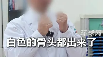杭州警方回应3岁男童疑遭父亲虐待：在异地发生，嫌疑人已被抓