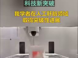 我国在人工肝脏领域取得突破性进展
