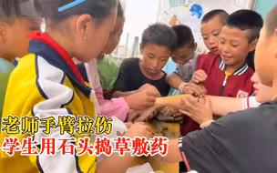 老师手臂拉伤学生用石头捣草敷药，孩子：我们会帮你把手治好