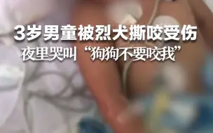 3岁男童路遇烈犬挣脱狗绳撕咬，多处受伤：晚上说梦话“狗狗不要咬我”，警方介入。