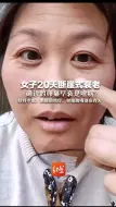 女子20天断崖式衰老  确诊的卵巢早衰是啥病？ 妇科专家：系提前绝经，和抽烟喝酒也有关