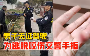 男子无证驾驶为逃脱咬伤交警手指，警方：涉嫌袭警，刑拘