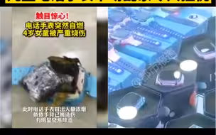 都市报道【敲响警钟！电话手表自燃烧伤女童！儿童电话手表市场乱象令人担忧】