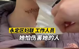 警方回应女子被前男友家暴割喉：嫌疑人仍被行拘 正等伤情鉴定结果