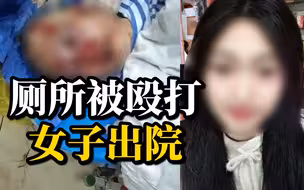 厕所被殴打女子右眼视力只有0.04，复明希望很小，至今未收到道歉