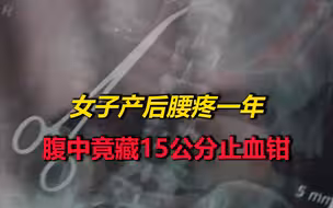 女子产后腰疼一年，腹中竟有藏15公分止血钳？当地卫健委介入调查