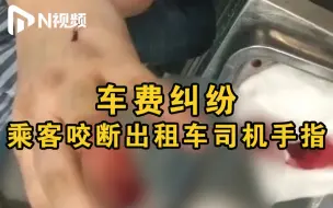 因车费纠纷，男子酒后咬断出租车司机手指被刑拘！司机断指已接上
