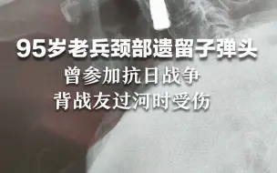 95岁老兵颈部遗留子弹头，曾参加抗日战争背战友过河时受伤
