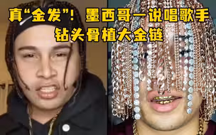 真“金发”！墨西哥一说唱歌手钻头骨植大金链