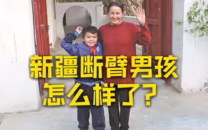 《平凡英雄》原型男孩恢复良好 长大想当医生