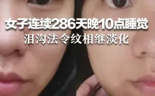 女子连续286天晚10点睡觉 泪沟法令纹相继淡化 乳腺结节都小了！