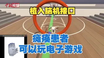 最新研究：手术植入脑机接口可助瘫痪患者玩电子游戏