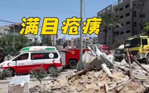 【巴以冲突】加沙地带物资短缺 伤员救援治疗进展受阻
