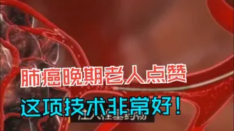 肺癌晚期肝转移老人跨越千里来济南寻求抗癌新疗法，术后激动点赞：这项技术非常好！