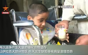 遗患无穷！美军贫铀弹致伊拉克儿童畸形