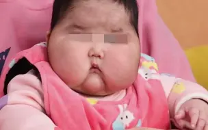 官方通报婴儿霜“大头娃娃”事件：产品含激素，线索移送警方