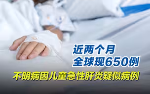近两个月全球现650例不明病因儿童急性肝炎疑似病例