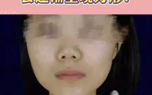 为何深覆合者的脸型