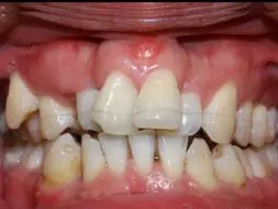 牙齿真的很神奇，还能这样移动？
