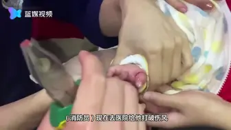 幼童手卡螺母内 消防员唱儿歌哄被救幼童