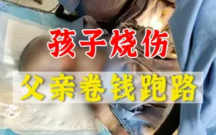 妈妈患癫痫，1岁婴儿掉进火炉烧伤，亲生父亲卷钱跑路