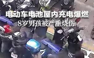 电动车爆燃8岁娃被严重烧伤 “爸爸，对不起，要花那么多钱！”