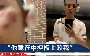 男子被陌生男子连咬十多口，全身9处伤口，订婚仪式都没办成