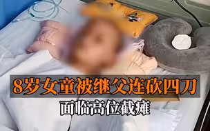 贵州8岁女童被继父连砍四刀面临高位截瘫 生父发声：他说过会待她如亲女儿