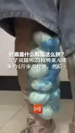 到底是什么鸭蛋这么拼？ 女子双腿绑24枚鸭蛋入境，重约4斤步态异常，然后……