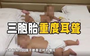 心疼！三胞胎全都重度耳聋 需植入人工耳蜗