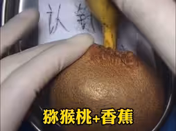 阴茎假体植入操作解析