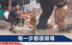 四川乐山一老人推车上街，左腿“假肢”是稻草做的，都变形了