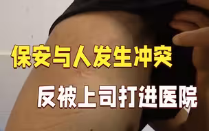 寒心！保安与人发生冲突 结果反被上司打进医院