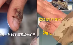 太心疼！不敢相信这是19岁武警战士的手