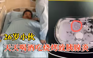 26岁小伙酗酒致胰腺炎每月要住院：不干预会营养不良甚至死亡
