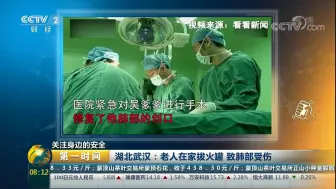 【第一时间】大爷在家拔火罐 竟把右肺给拔？没？了？