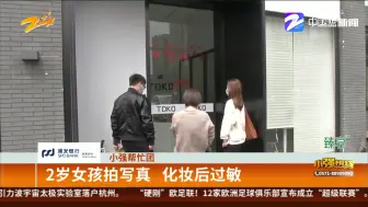 2岁女孩拍写真  化妆后过敏