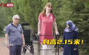土耳其一女子创造新世界纪录！ 身高2.15米行走需要支架