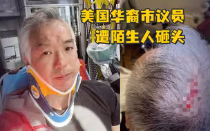 美国华裔市议员街头，遭陌生人用水泥块砸头